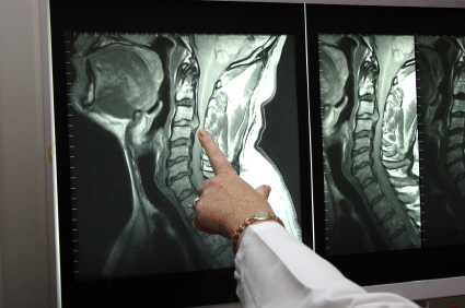 Spinal Fracture Treatment | Hemifacial Spasm Treatment Dallas TX | Addison TX