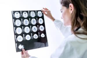 Brain Tumors and Brain Tumor Evaluation Dallas, TX Addison, TX