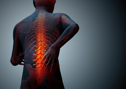 Spinal Cord Tumors Dallas, TX