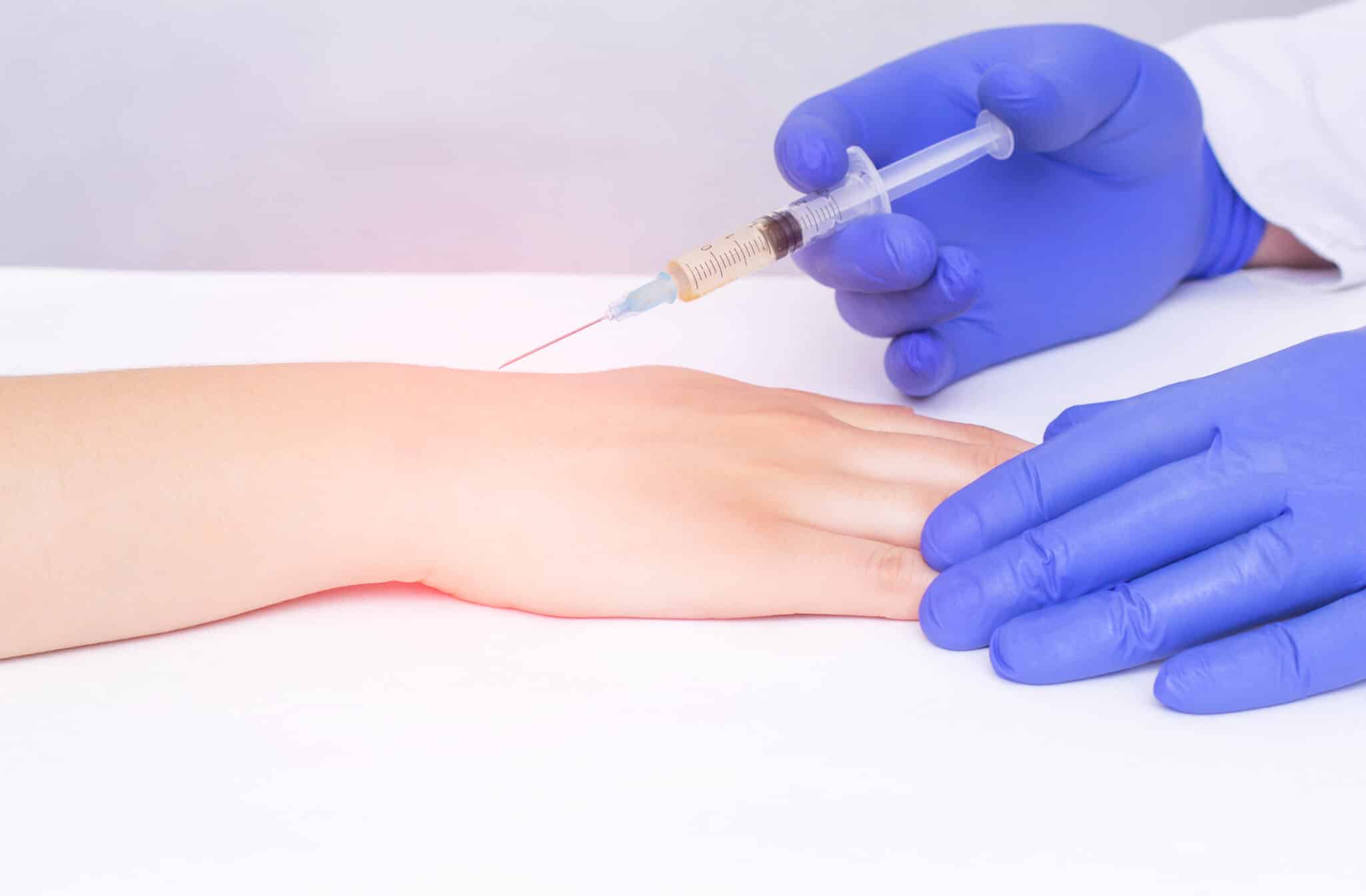 A doctor injects Corticosteroid to a young girl wrist to eliminate pain and inflammation from carpal tunnel syndrome.