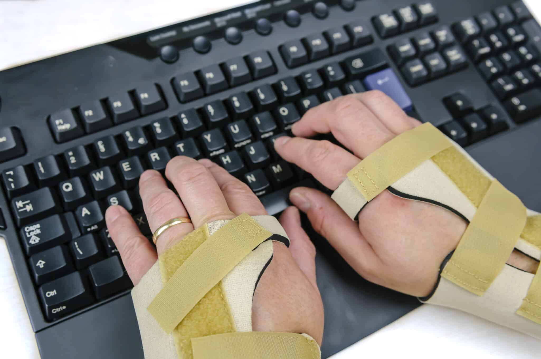 Man with Carpal Tunnel Syndrome, Rheumatoid Arthritis or Osteoarthritis and wearing wrist splints using a computer keyboard