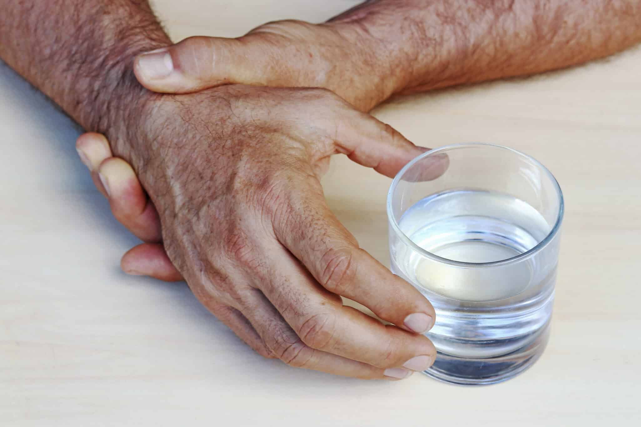 Close up of man's hands trembling from Parkinson's Disease in Dallas, TX